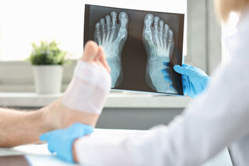 digital-x ray